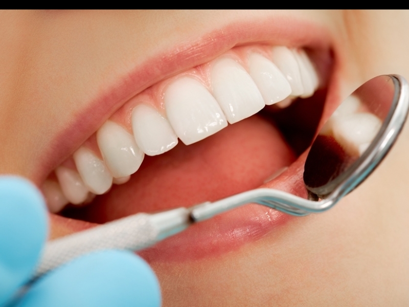 השתלות שיניים ללא פגיעה בניתוחים פלסטיים