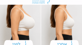 קטנה חזה